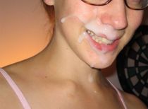 erozine